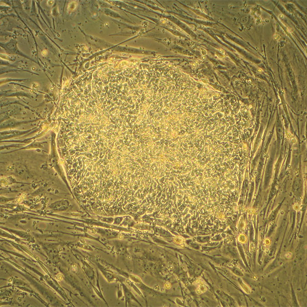 стволовые клетки,вирус,медицина, Уникальные способности стволовых клеток обусловлены древним вирусом